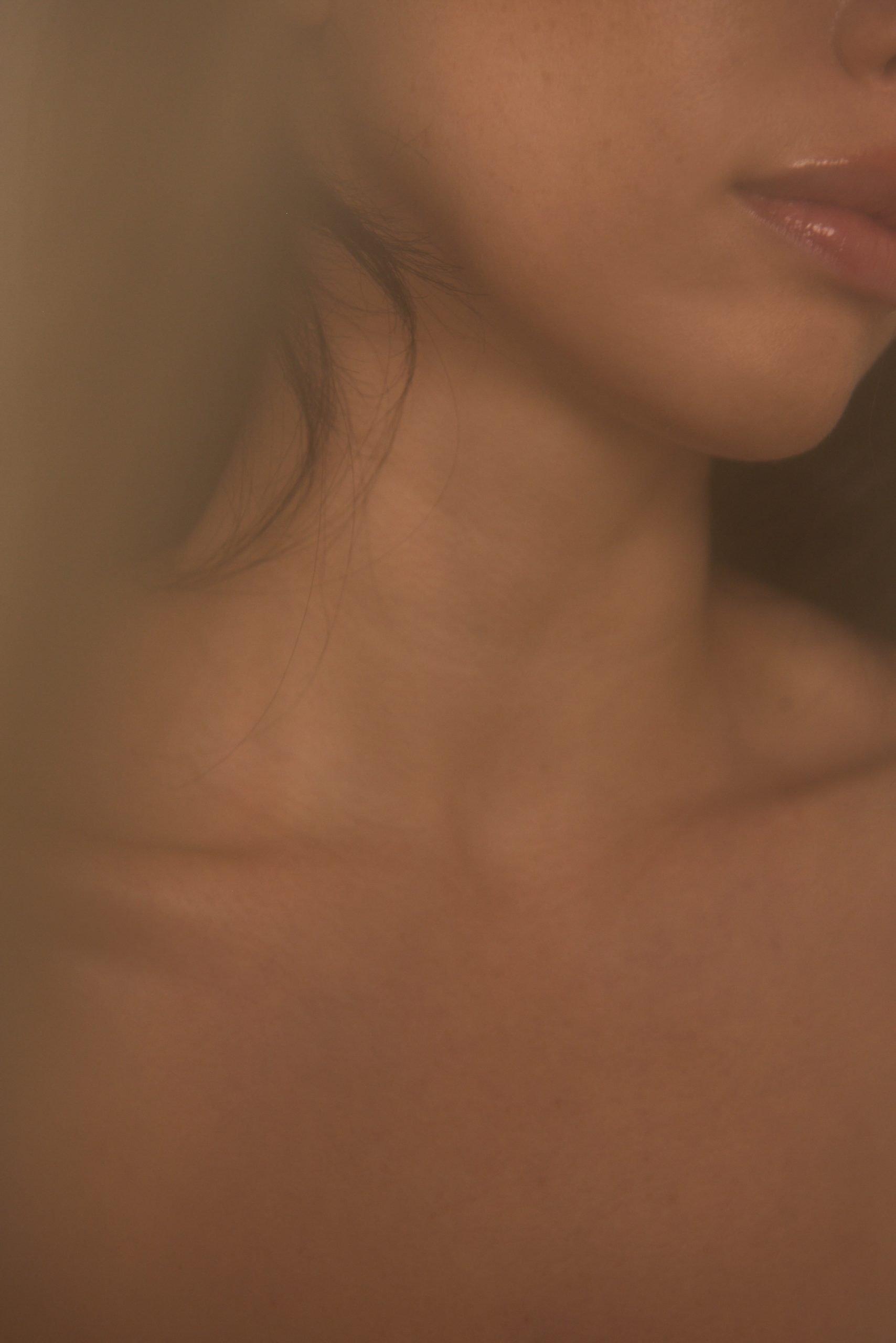 Microneedling Vancouver